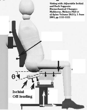 Ischial Tuberosity Pain