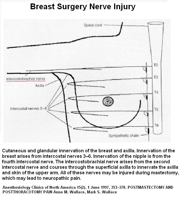 Venturing Out on a Limb: Axillary Web Syndrome