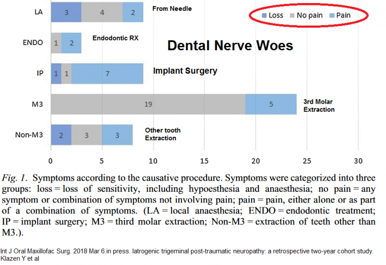 Dental Nerve Injury Pain Medical Musing