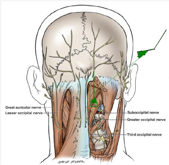 Understanding Postherpetic Neuralgia -- Treatment - WebMD