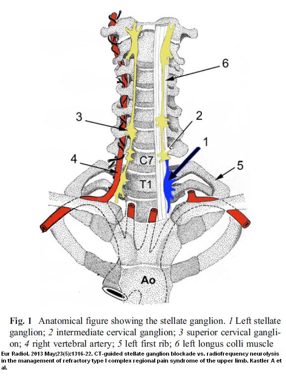 stellatepic