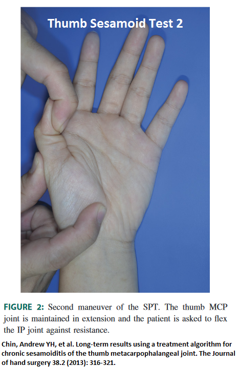 Alternate Cause of Thumb MCP Joint Pain – Sesamoiditis – With Tests